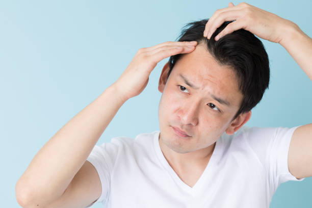 AGAに悩む男性の後ろ姿